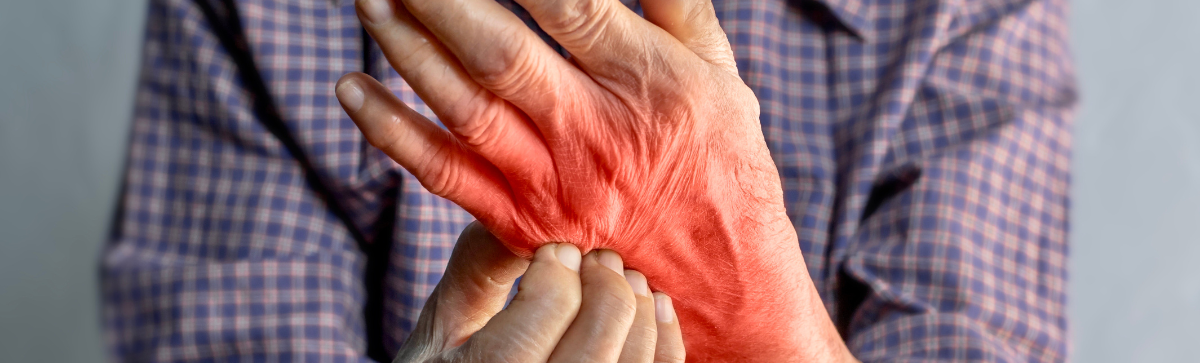 Elderly person itching irritated skin on his hand.
